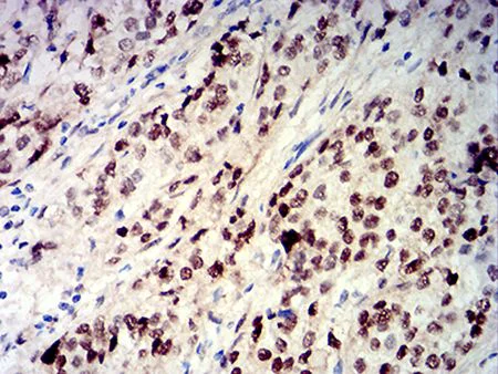 Immunohistochemistry (Formalin/PFA-fixed paraffin-embedded sections) - Anti-CIRP antibody [6E12D5] (AB233711)