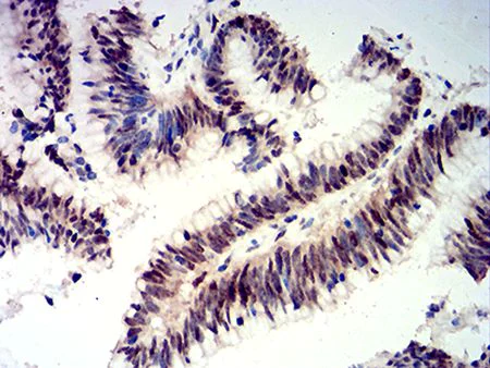 Immunohistochemistry (Formalin/PFA-fixed paraffin-embedded sections) - Anti-CIRP antibody [6E12D5] (AB233711)