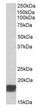 Western blot - Anti-CIRP antibody (AB106230)