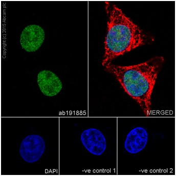 Immunocytochemistry/ Immunofluorescence - Anti-CIRP antibody [EPR18783] (AB191885)