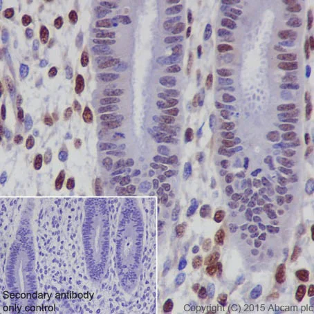 Immunohistochemistry (Formalin/PFA-fixed paraffin-embedded sections) - Anti-CIRP antibody [EPR18783] (AB191885)