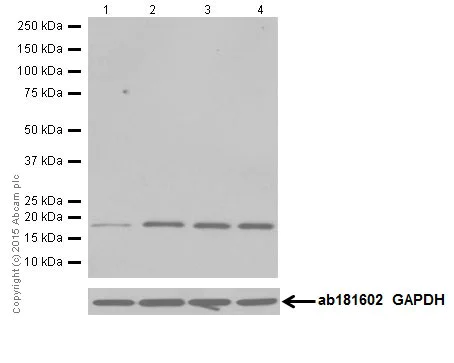 Western blot - Anti-CIRP antibody [EPR18783] (AB191885)