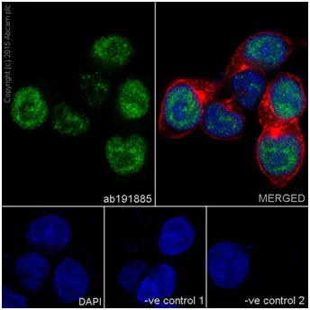 Immunocytochemistry/ Immunofluorescence - Anti-CIRP antibody [EPR18783] - BSA and Azide free (AB238946)