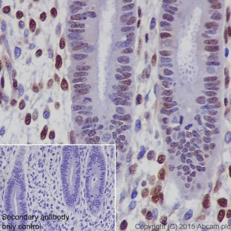 Immunohistochemistry (Formalin/PFA-fixed paraffin-embedded sections) - Anti-CIRP antibody [EPR18783] - BSA and Azide free (AB238946)