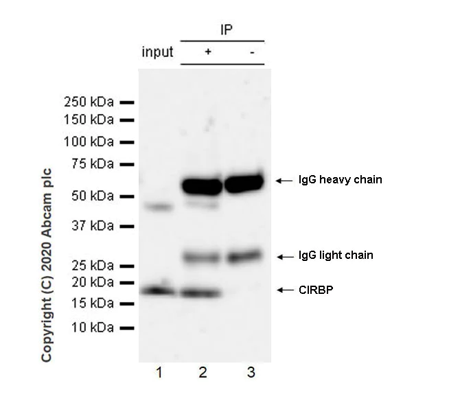 Immunoprecipitation - Anti-CIRP antibody [EPR23628-36] (AB246510)