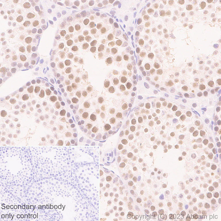 Immunohistochemistry (Formalin/PFA-fixed paraffin-embedded sections) - Anti-CIRP antibody [EPR27398-80] (AB315017)