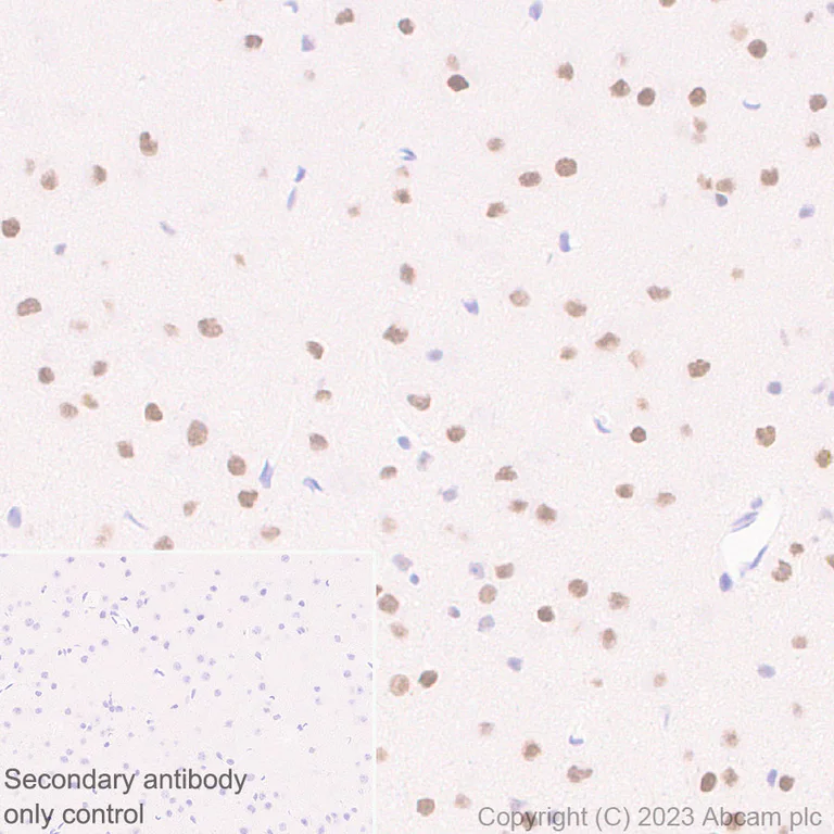 Immunohistochemistry (Formalin/PFA-fixed paraffin-embedded sections) - Anti-CIRP antibody [EPR27398-80] (AB315017)