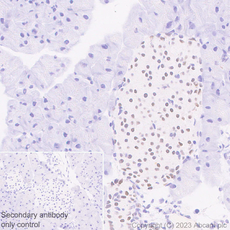 Immunohistochemistry (Formalin/PFA-fixed paraffin-embedded sections) - Anti-CIRP antibody [EPR27398-80] (AB315017)
