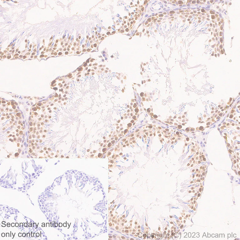 Immunohistochemistry (Formalin/PFA-fixed paraffin-embedded sections) - Anti-CIRP antibody [EPR27398-80] (AB315017)