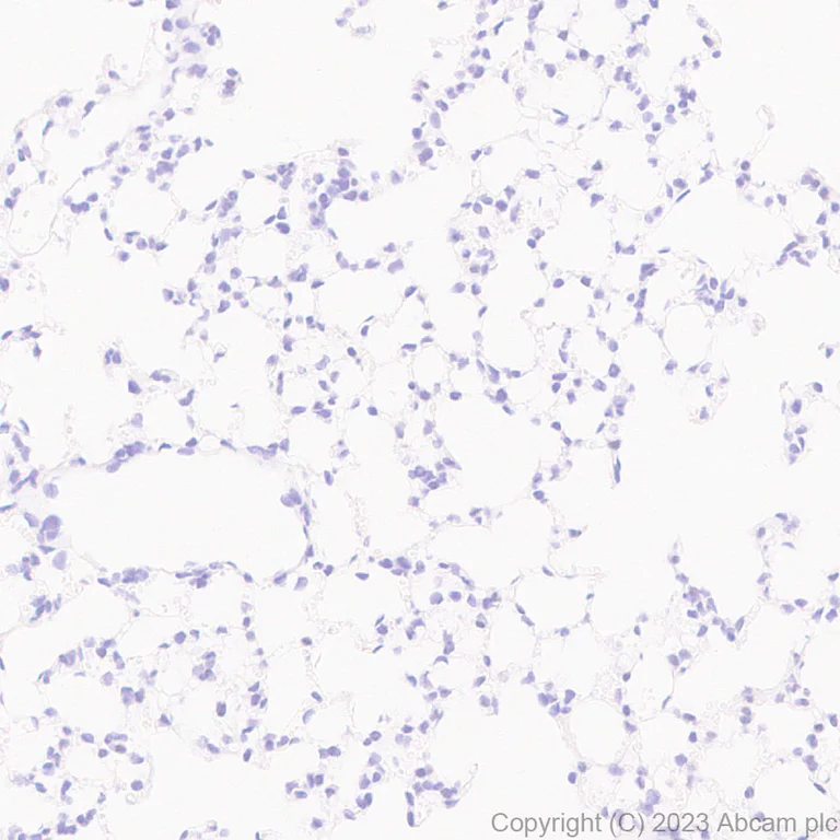 Immunohistochemistry (Formalin/PFA-fixed paraffin-embedded sections) - Anti-CIRP antibody [EPR27398-80] (AB315017)
