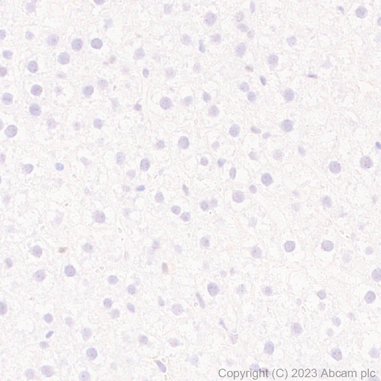 Immunohistochemistry (Formalin/PFA-fixed paraffin-embedded sections) - Anti-CIRP antibody [EPR27398-80] (AB315017)