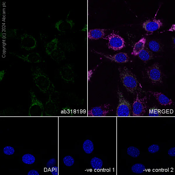 Immunocytochemistry/ Immunofluorescence - Anti-CISD1/MitoNEET antibody [EPR29116-27] (AB318199)