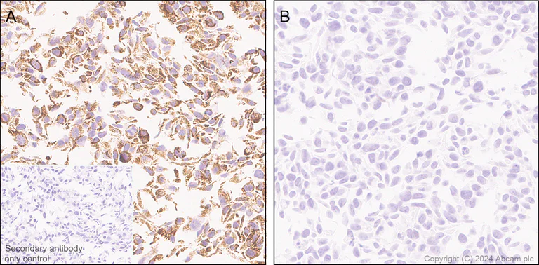 Immunohistochemistry (Formalin/PFA-fixed paraffin-embedded sections) - Anti-CISD1/MitoNEET antibody [EPR29116-27] - BSA and Azide free (AB318200)