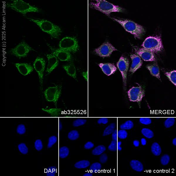 Immunocytochemistry/ Immunofluorescence - Anti-CISD2 antibody [EPR30277-16] (AB325526)