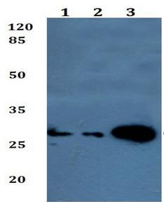 Western blot - Anti-CISH/CIS antibody (AB192383)