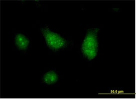 Immunocytochemistry/ Immunofluorescence - Anti-CISH/CIS antibody (AB88383)