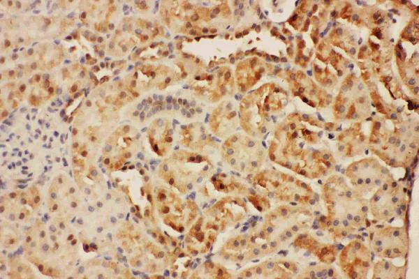 Immunohistochemistry (Formalin/PFA-fixed paraffin-embedded sections) - Anti-CISH/CIS antibody - C-terminal (AB191447)