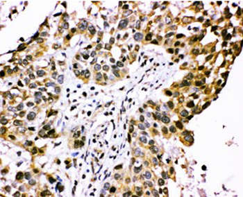 Immunohistochemistry (Formalin/PFA-fixed paraffin-embedded sections) - Anti-CISH/CIS antibody - C-terminal (AB191447)