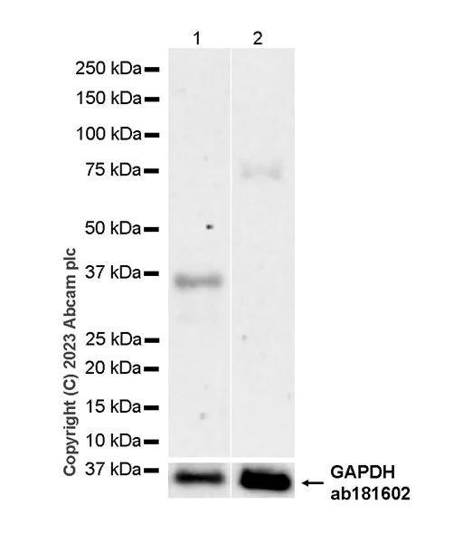 Western blot - Anti-CISH/CIS antibody [EPR25357-36] (AB308500)