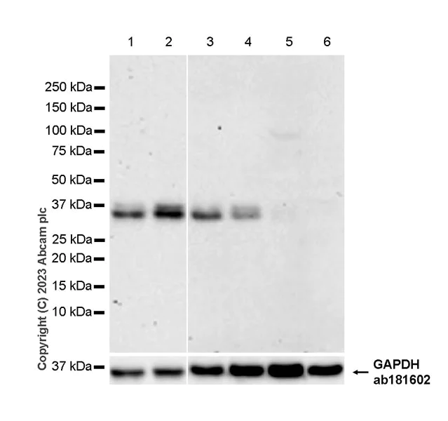 Western blot - Anti-CISH/CIS antibody [EPR25357-36] (AB308500)