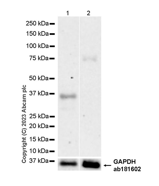 Western blot - Anti-CISH/CIS antibody [EPR25357-36] - BSA and Azide free (AB308501), expandable thumbnail