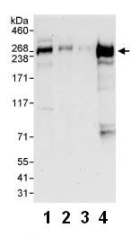 Western blot - Anti-CIT antibody (AB86782)