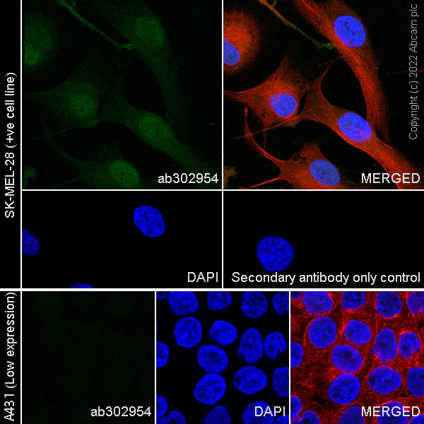Immunocytochemistry/ Immunofluorescence - Anti-CITED1 antibody [EPR24375-81] (AB302954)
