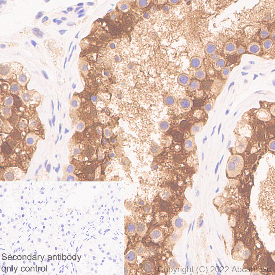 Immunohistochemistry (Formalin/PFA-fixed paraffin-embedded sections) - Anti-CITED1 antibody [EPR24375-81] (ab302954), expandable thumbnail