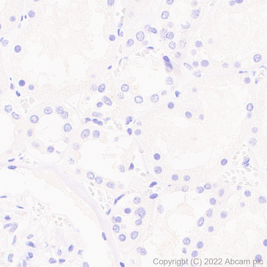 Immunohistochemistry (Formalin/PFA-fixed paraffin-embedded sections) - Anti-CITED1 antibody [EPR24375-81] (AB302954), expandable thumbnail