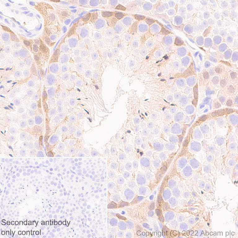 Immunohistochemistry (Formalin/PFA-fixed paraffin-embedded sections) - Anti-CITED1 antibody [EPR24375-81] - BSA and Azide free (AB302955)