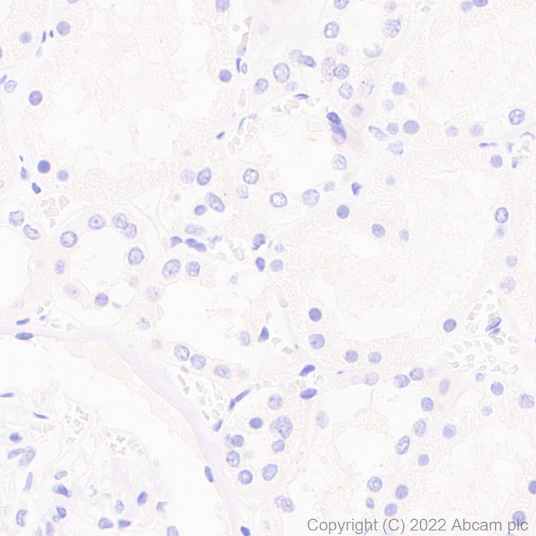 Immunohistochemistry (Formalin/PFA-fixed paraffin-embedded sections) - Anti-CITED1 antibody [EPR24375-81] - BSA and Azide free (AB302955)