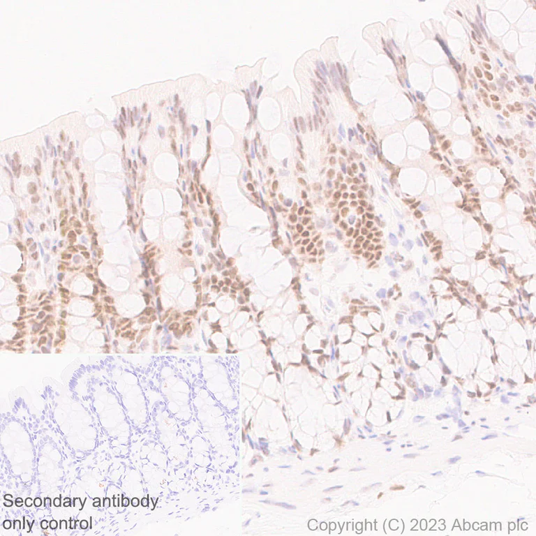 Immunohistochemistry (Formalin/PFA-fixed paraffin-embedded sections) - Anti-CITED2 antibody [EPR27399-62] (AB314757)
