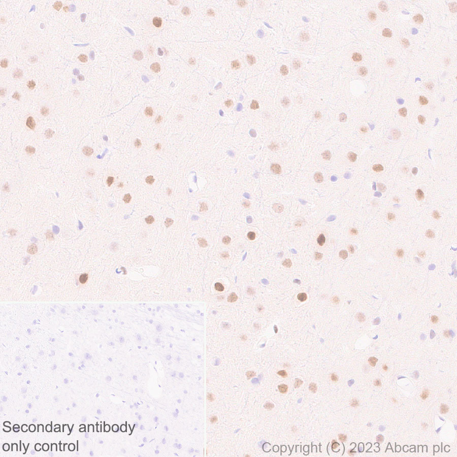 Immunohistochemistry (Formalin/PFA-fixed paraffin-embedded sections) - Anti-CITED2 antibody [EPR27399-62] (ab314757), expandable thumbnail