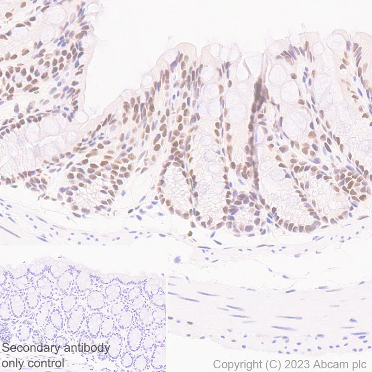 Immunohistochemistry (Formalin/PFA-fixed paraffin-embedded sections) - Anti-CITED2 antibody [EPR27399-62] - BSA and Azide free (AB314758)