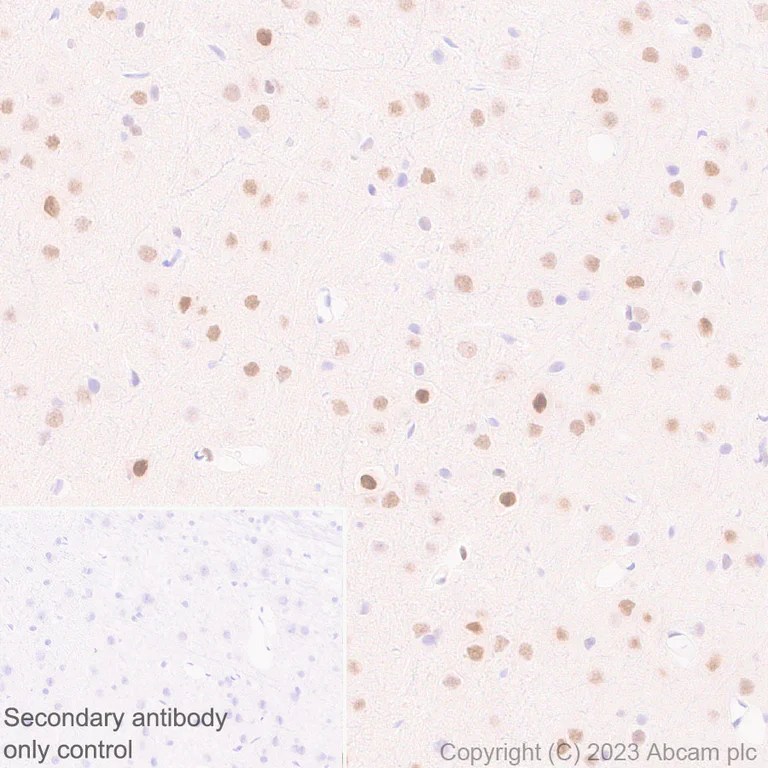 Immunohistochemistry (Formalin/PFA-fixed paraffin-embedded sections) - Anti-CITED2 antibody [EPR27399-62] - BSA and Azide free (AB314758)
