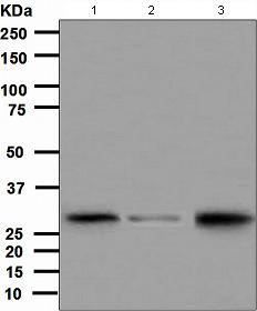 Western blot - Anti-CITED2 antibody [EPR3416(2)] (AB108345), expandable thumbnail