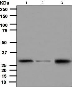 Western blot - Anti-CITED2 antibody [EPR3416(2)] (AB108345)