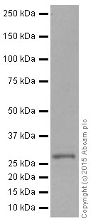 Western blot - Anti-CITED2 antibody [EPR3416(2)] (AB108345), expandable thumbnail