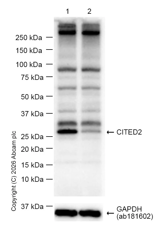 Western blot - Anti-CITED2 antibody [EPR3416(2)] (AB108345)