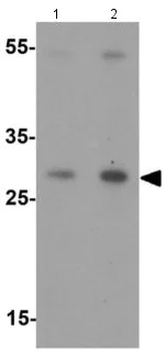 Western blot - Anti-CITED2 antibody - N-terminal (AB189946)