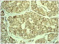 Immunohistochemistry (Formalin/PFA-fixed paraffin-embedded sections) - Anti-CITED4 antibody [EPR2702] (AB134072)