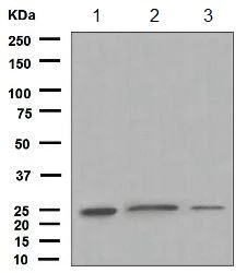 Western blot - Anti-CITED4 antibody [EPR2702] (AB134072)