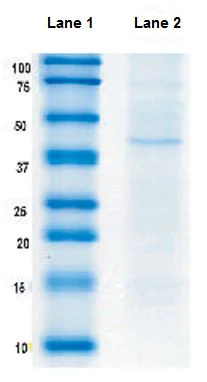 Immunoprecipitation - Anti-Citrate synthetase antibody [2H8BB6] (AB128564)