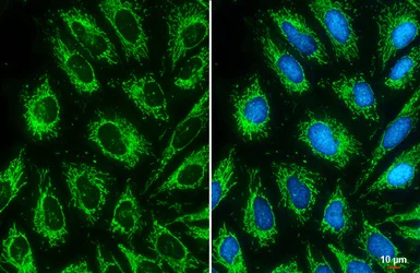 Immunocytochemistry/ Immunofluorescence - Anti-Citrate synthetase antibody (AB96600)