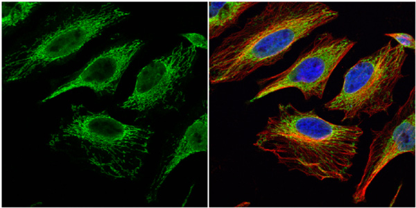 Immunocytochemistry/ Immunofluorescence - Anti-Citrate synthetase antibody (AB96600), expandable thumbnail