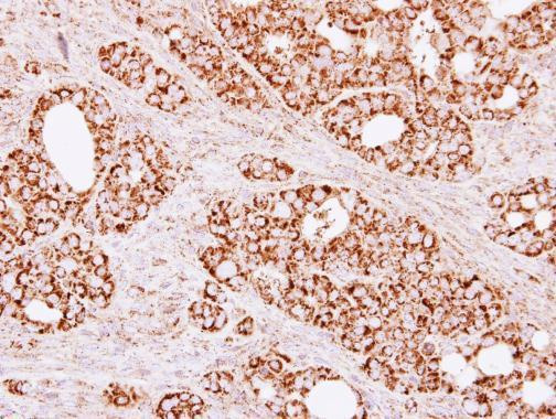 Immunohistochemistry (Formalin/PFA-fixed paraffin-embedded sections) - Anti-Citrate synthetase antibody (ab96600), expandable thumbnail