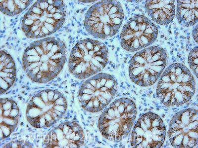 Immunohistochemistry (Formalin/PFA-fixed paraffin-embedded sections) - Anti-Citrate synthetase antibody (ab96600), expandable thumbnail