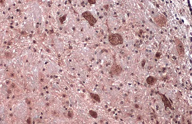 Immunohistochemistry (Formalin/PFA-fixed paraffin-embedded sections) - Anti-Citrate synthetase antibody (AB96600)