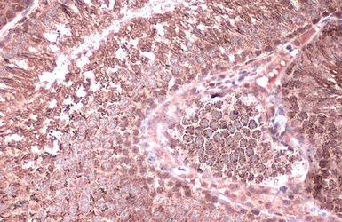 Immunohistochemistry (Formalin/PFA-fixed paraffin-embedded sections) - Anti-Citrate synthetase antibody (AB96600)