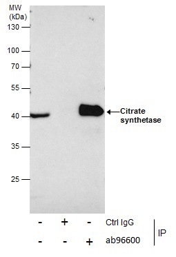 Immunoprecipitation - Anti-Citrate synthetase antibody (AB96600), expandable thumbnail